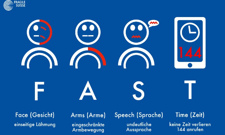 Eine Grafik, die den FAST-Test zeigt. Die Symptome eines Schlaganfall werden mit Strichmännchen und Text erläutert: einseitige Lähmung im Gesicht, eingeschränkte Armbewegung, undeutliche Aussprache und keine Zeit verlieren - 144 anrufen. 